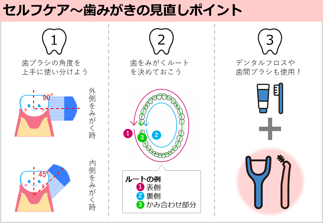 歯周病セルフケア　歯みがきの見直しポイント3つ