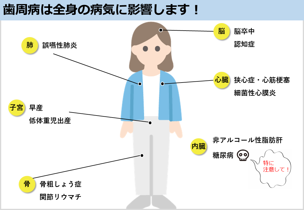 歯周病は全身の病気に影響するよ